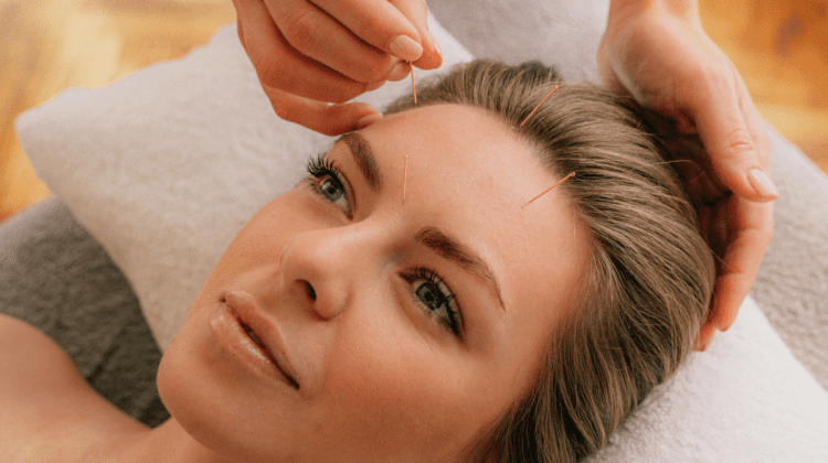 Agopuntura viso | Treatwell