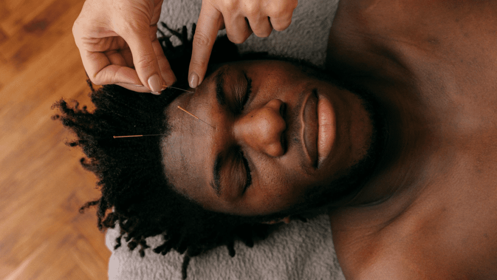 Agopuntura viso_4 | Treatwell