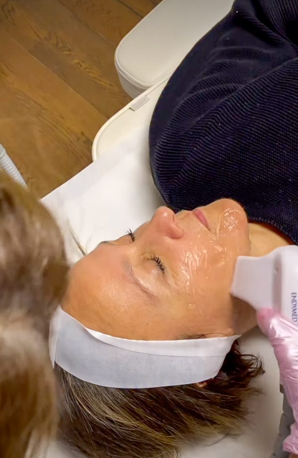 Radiofrequenza viso, IG @sadaf_jaffari | Treatwell