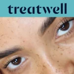 Banner Treatwell turchese con primo piano di ciglia naturalmente sollevate dopo una laminazione ciglia coreana, su pelle con lentiggini